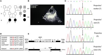 A de novo Mutation in the MTUS1 Gene Decreases the Risk of Non-compaction of Ventricular Myocardium via the Rac1/Cdc42 Pathway